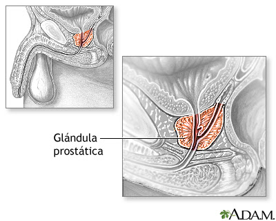 Próstata: qué es, qué funciones tiene, ...